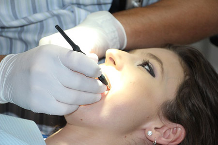 Что такое установка виниров на зубы?