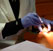 Лечение зубов быстро и эффективно у стоматолога
