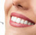Чистка зубов Air Flow: здоровые зубы надолго